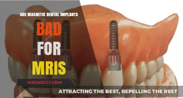 Exploring the Safety of Magnetic Dental Implants in MRI Scans