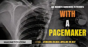 Pacemaker Patients and Magnets: Understanding the Risks and Safety Measures