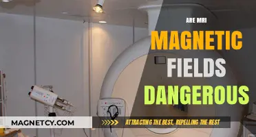 Unveiling the Truth: Are MRI Magnetic Fields Dangerous?