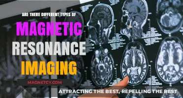 Exploring the Varieties of Magnetic Resonance Imaging Techniques