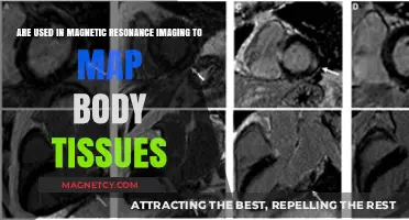 How MRI Uses Magnetic Fields to Map Body Tissues