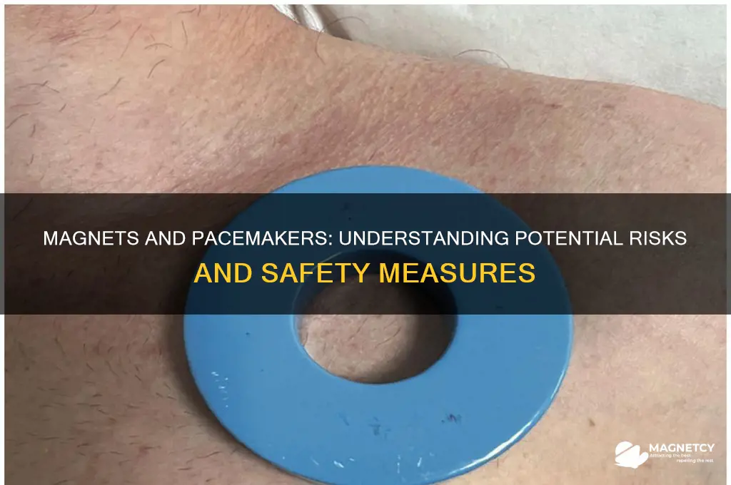 can a magnet affect a pacemaker