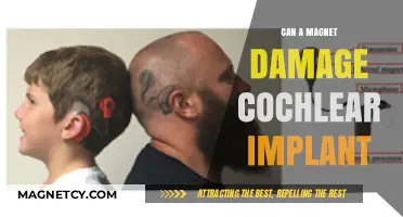 Magnets and Cochlear Implants: Potential Risks and Safety Tips