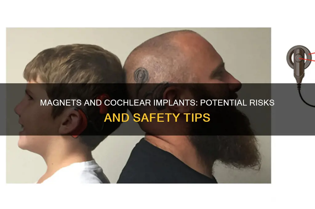 can a magnet damage cochlear implant