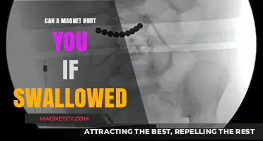 Swallowed Magnets: Potential Dangers and Health Risks Explained