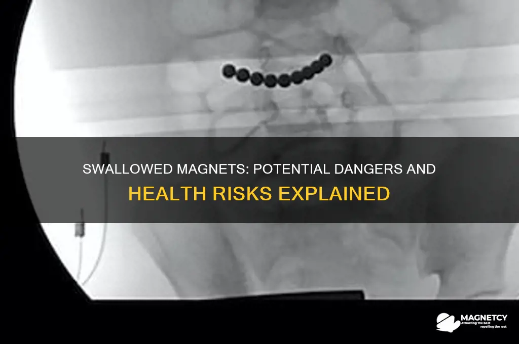 can a magnet hurt you if swallowed