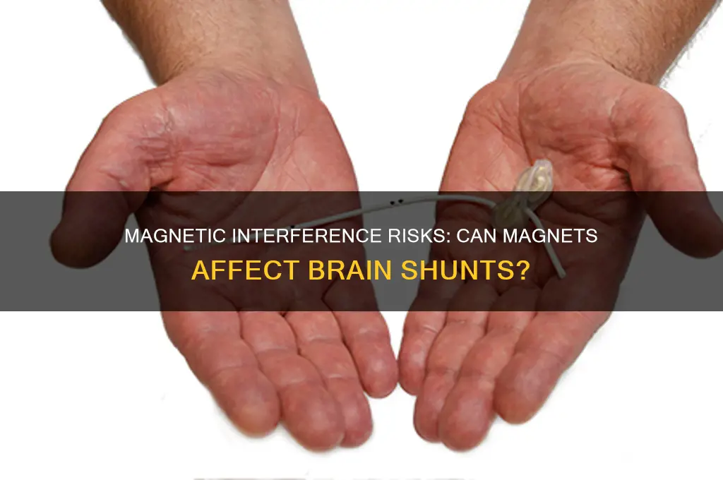 can a magnet interfere with shunt in brain
