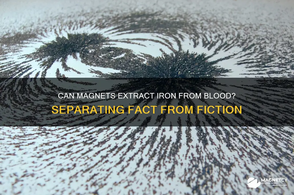 can a magnet remove iron from your blood