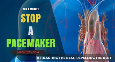 Magnets and Pacemakers: Debunking Myths and Ensuring Safety