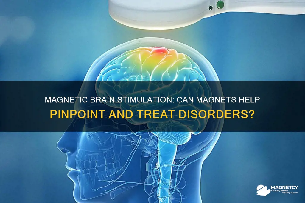 can a magnet to a brain help pin