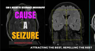 Can Magnetic Resonance Angiography Trigger Seizures? Exploring the Risks