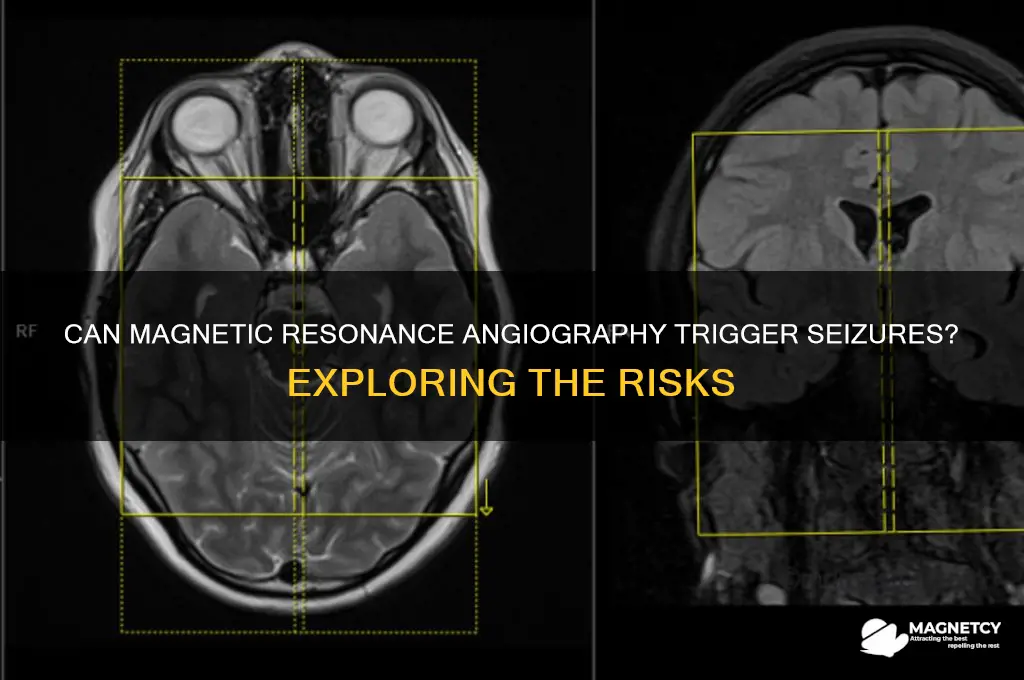 can a magnetic resonance angiography cause a seizure
