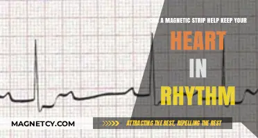 Magnetic Strips: A Potential Heart Rhythm Regulator?