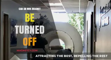 Can MRI Magnets Be Turned Off? Exploring Safety and Functionality