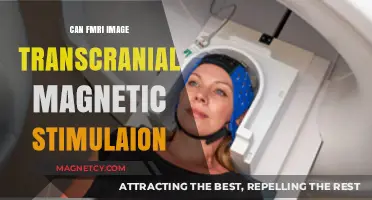 Can fMRI Accurately Image Transcranial Magnetic Stimulation Effects?