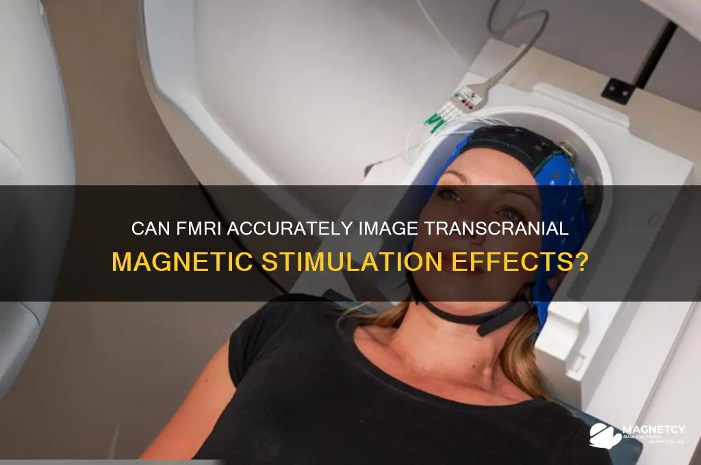 can fmri image transcranial magnetic stimulaion