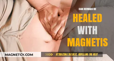 Magnetic Healing for Hernias: Fact or Fiction? Exploring Alternative Therapies