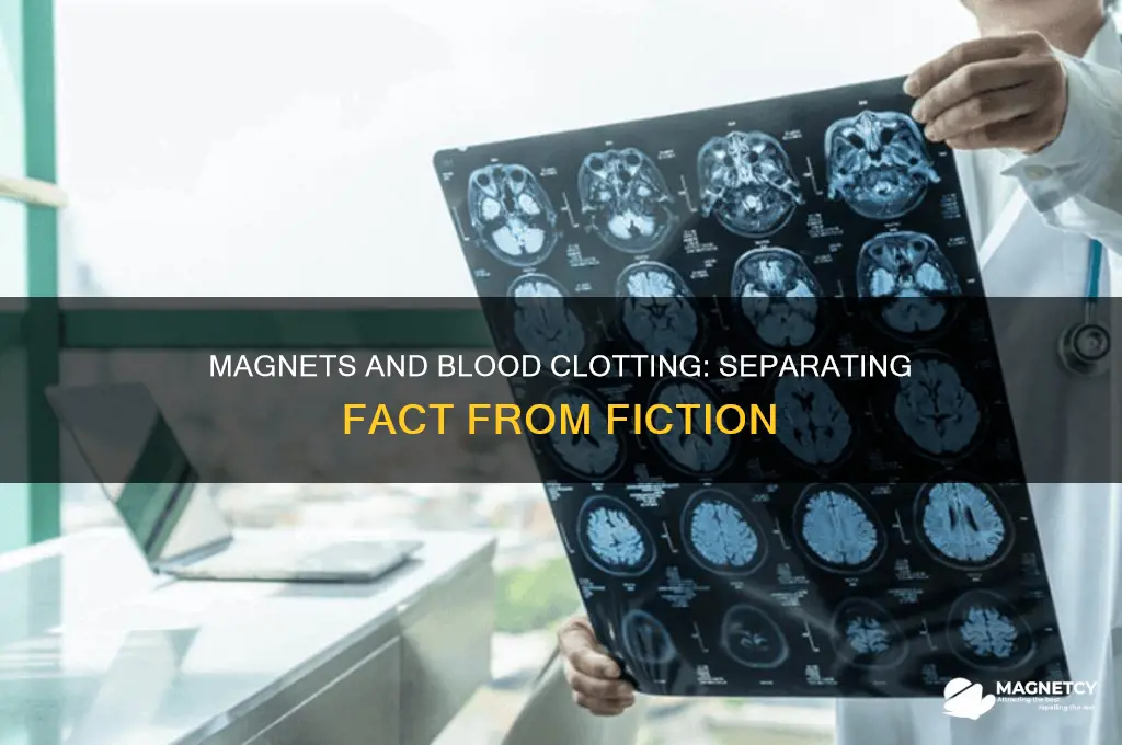 can holding a magnet clot blood