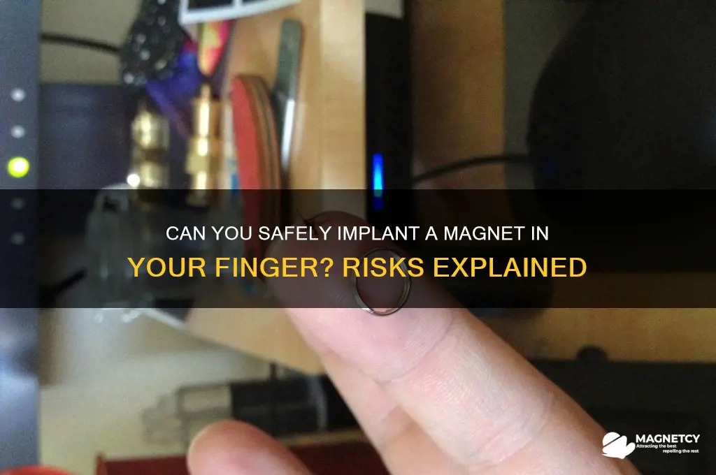 can i put a magnet in my finger