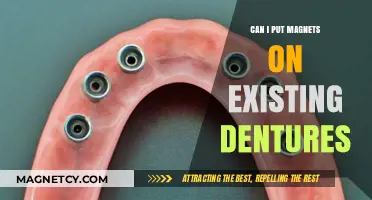 Magnets on Dentures: Can You Enhance Existing Prosthetics with Magnetic Attachments?