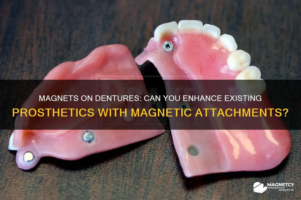 can i put magnets on existing dentures
