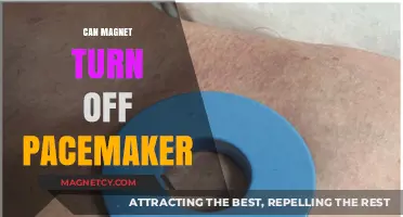 Can Magnets Interfere with Pacemakers? Debunking the Myth