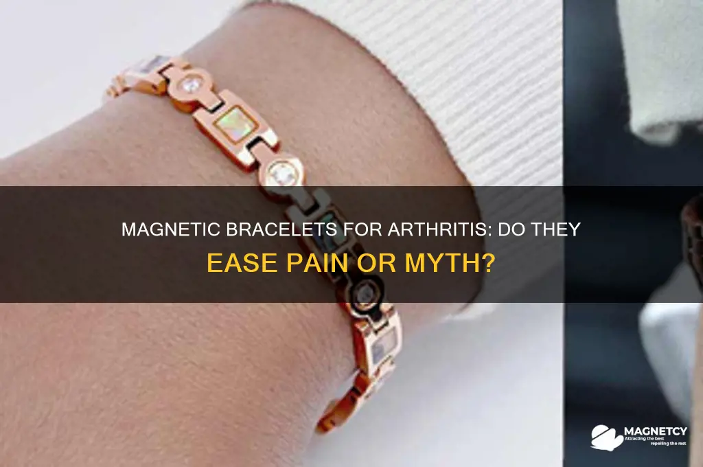 can magnetic bracelets help arthritis