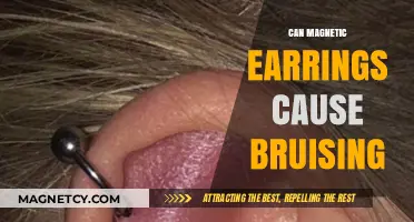 Can Magnetic Earrings Cause Bruising? Exploring the Risks and Facts