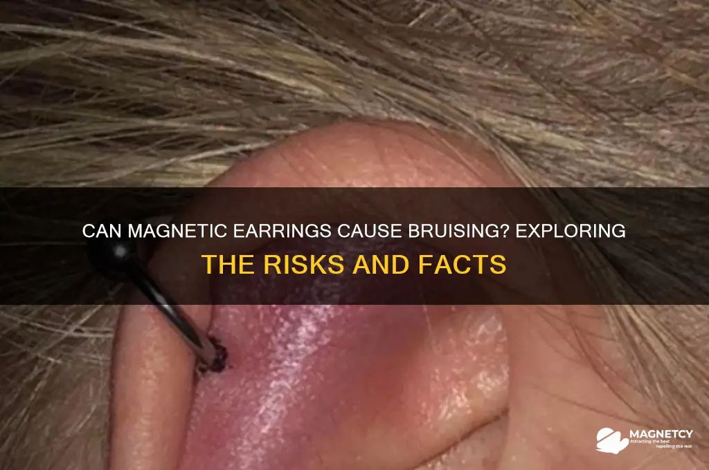 can magnetic earrings cause bruising