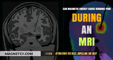 MRI Magnetic Energy: Unraveling Burning Pain Causes and Concerns