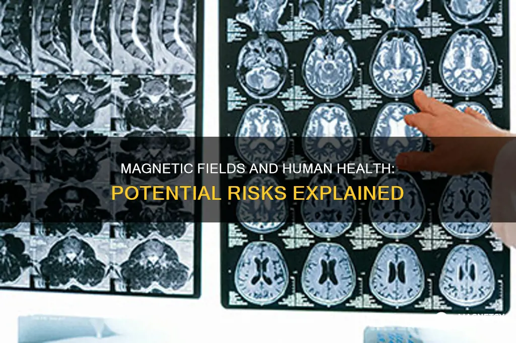 can magnetic fields be dangerous to people