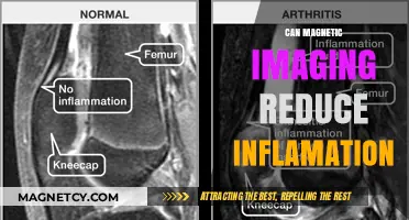 Magnetic Imaging: A Potential Breakthrough in Reducing Inflammation?