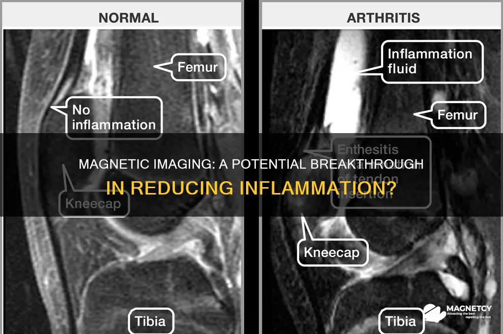 can magnetic imaging reduce inflamation