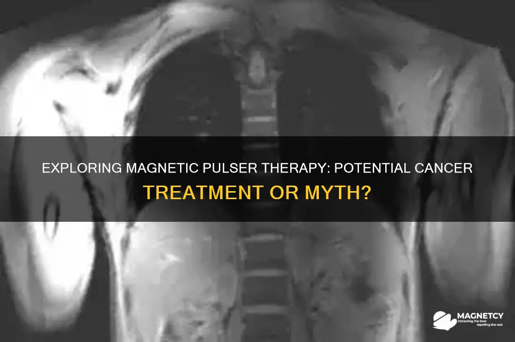 can magnetic pulser cure cancer