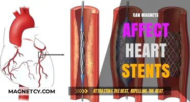 Magnets and Heart Stents: Potential Risks and Safety Concerns Explored