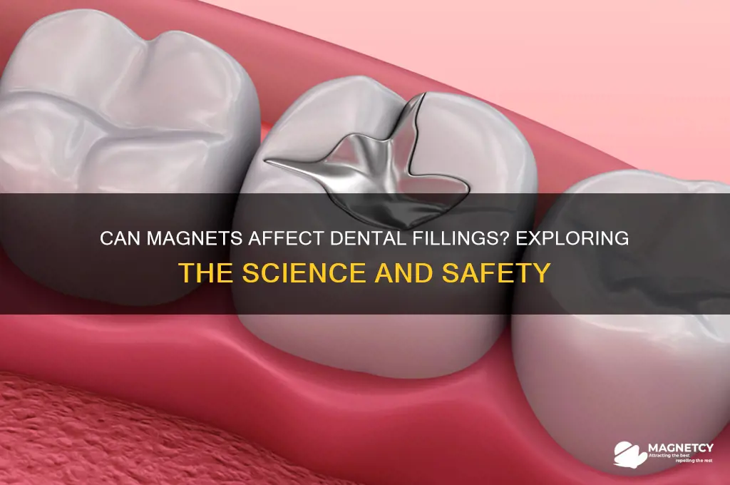 can magnets affect my fillings