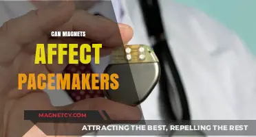 Magnets and Pacemakers: Understanding Potential Risks and Safety Measures