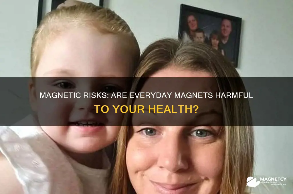 can magnets be bad for you
