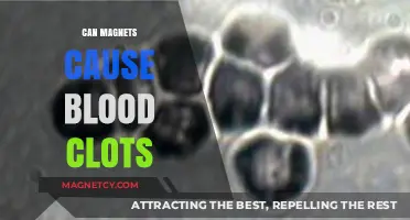 Magnets and Blood Clots: Unraveling the Myths and Facts