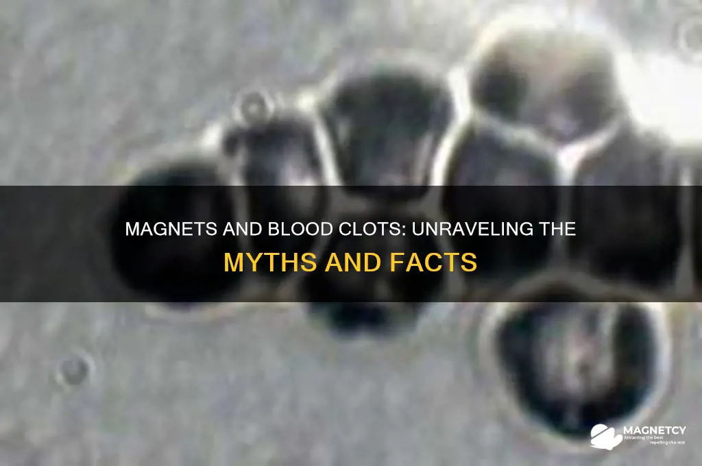 can magnets cause blood clots