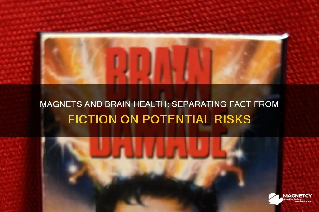 can magnets cause brain damag