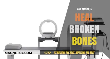 Magnetic Healing: Can Magnets Accelerate Broken Bone Recovery?