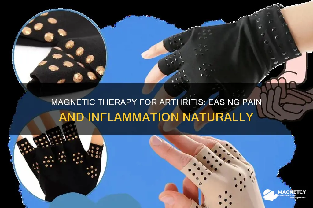 can magnets help arthritis