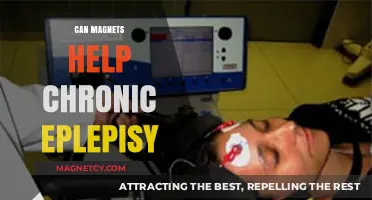 Magnetic Therapy for Chronic Epilepsy: Potential Benefits and Research Insights