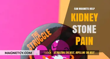Magnetic Relief for Kidney Stones: Fact or Fiction?