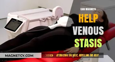 Magnetic Therapy for Venous Stasis: Potential Benefits and Limitations