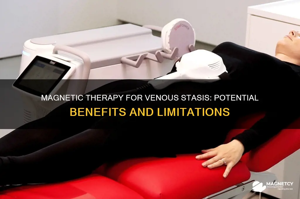 can magnets help venous stasis