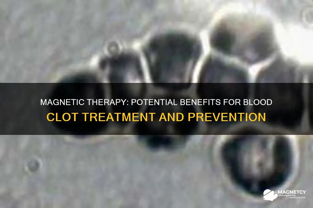 can magnets help with blood clots