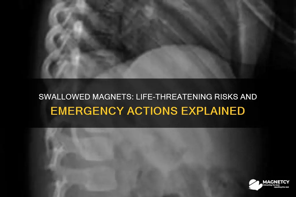 can magnets kill you if you swallow them