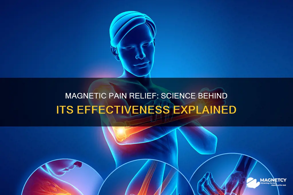 can magnets relieve pain live science